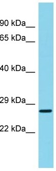 Anti-C22orf13 antibody - C-terminal (ab157680) at 1 µg/ml + Human fetal liver lysate at 10 µg