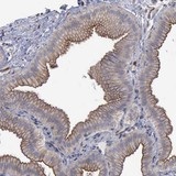 ab121128 at 1/75 dilution staining C22orf23 in Paraffin-emebedded Human gallbladder tissue by Immunohistochemistry. 