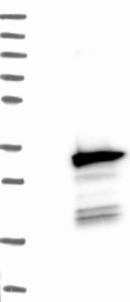 Lane 1: Marker [kDa] 250; 130; 95; 72; 55; 36; 28; 17; 10  Lane 2: Negative control (vector only transfected HEK293T lysate)  Lane 3: Over-expression Lysate (Co-expressed with a C-terminal myc-DDK tag (~3.1 kDa) in mammalian HEK293T cells.