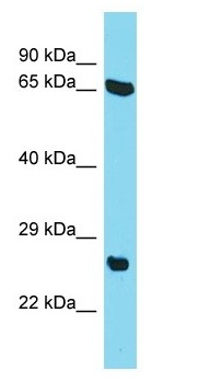 Anti-C22orf23 antibody (ab157656) at 1 µg/ml + HepG2 whole cell lysate at 10 µg