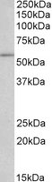 Anti-C22orf28 antibody (ab118284) at 0.05 µg/ml + Jurkat lysate (in RIPA buffer) at 35 µgdeveloped using the ECL technique