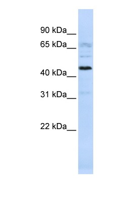 Anti-C22orf9 antibody (ab83331) at 1 µg/ml (in 5% skim milk / PBS buffer) + 721_B cell lysate at 10 µgSecondaryHRP conjugated anti-Rabbit IgG at 1/50000 dilution