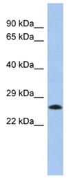 Anti-C2orf27 antibody (ab90525) at 1 µg/ml + Human fetal lung lysate at 10 µgSecondaryanti-Rabbit IgG HRP at 1/50000 dilution