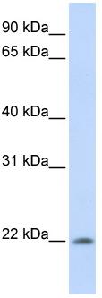 Anti-C2orf28 antibody (ab80443) at 1 µg/ml + Fetal muscle lysate at 10 µgSecondaryHRP conjugated anti-Rabbit IgG at 1/50000 dilutionObserved band size : 22 kDa (why is the actual band size different from the predicted?)