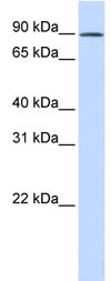 Anti-C2orf3 antibody (ab83407) at 1 µg/ml (in 5% skim milk / PBS buffer) + Fetal lung lysate at 10 µgSecondaryHRP conjugated anti-Rabbit IgG at 1/50000 dilution