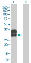 All lanes : Anti-C2orf3 antibody (ab69069) at 1/500 dilutionLane 1 : C2orf3 transfected 293T cell lysateLane 2 : Non-transfected 293T cell lysateLysates/proteins at 25 µg per lane.SecondaryGoat anti-mouse IgG (H&L)-HRP conjugated at 1/2500 dilution