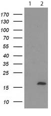 All lanes : Anti-C2orf40 antibody [1A10] (ab119079) at 1/2000 dilutionLane 1 : HEK293T cells transfected with pCMV6-ENTRY control Lane 2 : HEK293T cells transfected with pCMV6-ENTRY C2orf40 Lysates/proteins at 5 µg per lane.