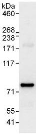 Detection of C2orf44 in Immunoprecipitates of 293T whole cell lysates (1 mg for IP, 20% of IP loaded) using ab118806 at 6 µg/mg lysate for IP. For WB detection an anti-C2orf44 antibody which recognizes a downstream epitope was used at 0.4 µg/ml. Detection: Chemiluminescence with an exposure time of 10 seconds.