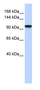 Anti- C21orf66 antibody (ab82669) at 1 µg/ml (5% skim milk/ PBS buffer) + fetal muscle cell lysate at 10 µg with gel concentration: 6-18%SecondaryHRP conjugated anti-Rabbit IgG at 1/50000 dilution