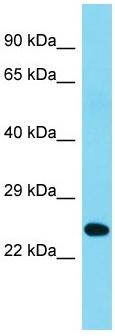 Anti-C2orf49 antibody (ab157631) at 1 µg/ml + Human placenta lysate at 10 µg