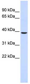 Anti-C2orf60 antibody (ab84682) at 1 µg/ml (in 5% skim milk / PBS buffer) + human fetal muscle lysate at 10 µgSecondaryHRP conjugated anti-Rabbit IgG at 1/50000 dilution