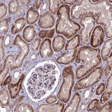Immunohistochemical analysis of Formalin-fixed, paraffin embedded Human kidney tissue labelled with C2orf76 antibody at 1/10 dilution.