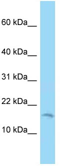Anti-C2orf76 antibody (ab125466) at 1 µg/ml + 721_B cell lysate at 10 µg