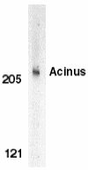 Anti-Acinus antibody (ab7352) at 1 µg/ml + K562 whole cell lysate 