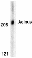 Anti-Acinus antibody (ab7353) at 0.5 µg/ml + K562 whole cell lysate 