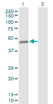 All lanes : Anti-C3a Receptor antibody (ab103629) at 5 µg/mlLane 1 : C3a Receptor transfected 293T cell lysateLane 2 : Non-transfected 293T cell lysateLysates/proteins at 25 µg per lane.