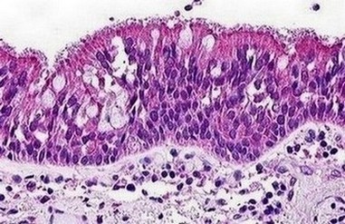 Immunohistochemical analysis of formalin fixed, paraffin embedded Human lung tissue (Respiratory epithelium) labelling C3a Receptor with ab140777 at 1.25 µg/ml.