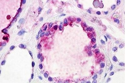 Immunohistochemical analysis of formalin fixed, paraffin embedded Human thyroid tissue labelling C3a Receptor with ab140777 at 1.25 µg/ml.