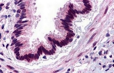 Immunohistochemical analysis of Human lung tissue labelling C3a Receptor with ab140788 at 17.3 µg/ml.