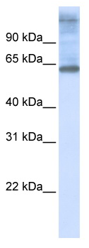 Anti-C3orf17 antibody (ab83796) at 1 µg/ml + 721_B cell lysate at 10 µgSecondaryHRP conjugated anti-Rabbit IgG at 1/50000 dilution