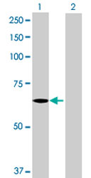 All lanes : Anti-C3orf17 antibody (ab167689) at 1/500 dilutionLane 1 : C3orf17 transfected 293T cell lysateLane 2 : Non-transfected 293T cell lysateLysates/proteins at 15 µl per lane.SecondaryGoat Anti-Mouse IgG (H&L)-HRP at 1/2500 dilution