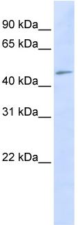 Anti-C3orf17 antibody (ab83881) at 1 µg/ml (in 5% skim milk / PBS buffer) + HeLa cell lysate at 10 µgSecondaryHRP conjugated anti-Rabbit IgG at 1/50000 dilution