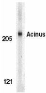 Anti-Acinus antibody (ab7354) at 1 µg/ml + K562 whole cell lysate