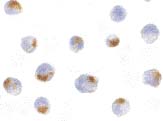 ab7354 at 5µg/ml staining Acinus in K562 cells by ICC/IF