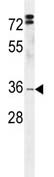 Anti-C3orf37 antibody (ab107586) at 1/100 dilution + HL-60 cell line lysate at 35 µg