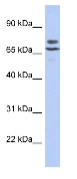 Anti-C3orf39 antibody (ab89975) at 1 µg/ml + SH-SYSY cell lysate at 10 µgSecondaryHRP conjugated anti-Rabbit IgG at 1/50000 dilution