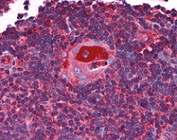 ab118594, at 5 µg/ml, staining C3orf54 in formalin fixed, paraffin embedded Human thymus tisse by Immunohistochemistry. 