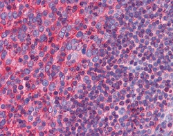 ab118594, at 5 µg/ml, staining C3orf54 in formalin fixed, paraffin embedded Human tonsil tisse by Immunohistochemistry.