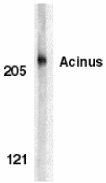 Anti-Acinus antibody (ab7355) at 1 µg/ml + K562 whole cell lysate