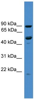Anti-C3orf59 antibody (ab108081) at 1 µg/ml + 293T cell lysate at 10 µg