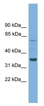 Anti-C3orf67 antibody (ab105745) at 1 µg/ml + OVCAR-3 cell lysate at 10 µg