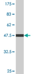 Anti-C4 binding protein antibody (ab76505) at 5 µg/ml + Immunogen at 0.2 µgSecondaryGoat Anti-Mouse IgG (H&L)-HRP Conjugate at 1/5000 dilution