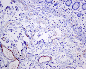 Immunohistochemical analysis of paraffin-embedded Human colon tissue labeling C4a with ab170942 at 1/250 dilution.
