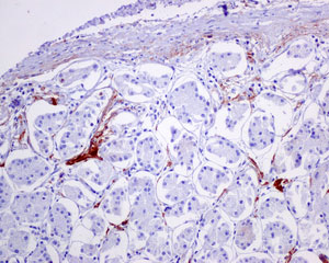 Immunohistochemical analysis of paraffin-embedded Human stomach tissue labeling C4a with ab170942 at 1/250 dilution.