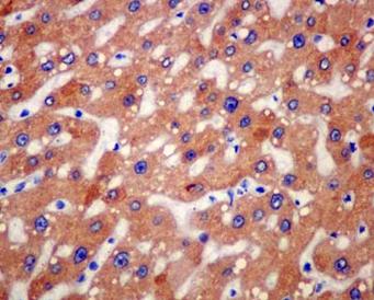 Immunohistochemical analysis of paraffin-embedded Human liver tissue labeling C4b with ab181241 at 1/250 dilution followed by prediluted HRP Polymer for Rabbit IgG. Counter stained with hematoxylin.