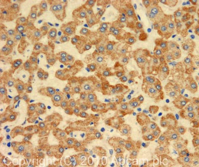 IHC image of C4d staining in human liver carcinoma formalin fixed paraffin embedded tissue section, performed on a Leica BondTM system using the standard protocol F. The section was pre-treated using heat mediated antigen retrieval with sodium citrate buffer (pH6, epitope retrieval solution 1) for 20 mins. The section was then incubated with ab87424, 5µg/ml, for 15 mins at room temperature and detected using an HRP conjugated compact polymer system. DAB was used as the chromogen. The section was then counterstained with haematoxylin and mounted with DPX.
