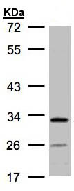 Anti-C4orf19 antibody (ab97843) at 1/1000 dilution + H1299 whole cell lysate at 30 µg