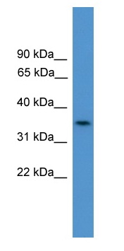 Anti-C4orf19 antibody (ab108087) at 1 µg/ml + COLO205 cell lysate