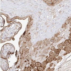 ab122126, at a 1/350 dilution, staining C4orf21 in paraffin-embedded Human placenta tissue by Immunohistochemistry.