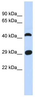 Anti-C4orf22 antibody (ab87295) at 1 µg/ml (in 5% skim milk / PBS buffer) + Human fetal muscle lysate at 10 µgSecondaryHRP conjugated anti-Rabbit IgG at 1/50000 dilution