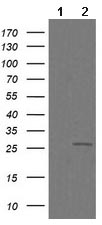 All lanes : Anti-C4orf22 antibody [1A6] (ab139352) at 1/2000 dilutionLane 1 : HEK293T cell lysate transfected with pCMV6-ENTRY controlLane 2 : HEK293T cell lysate transfected with pCMV6-ENTRY C4orf22 cDNALysates/proteins at 5 µg per lane.