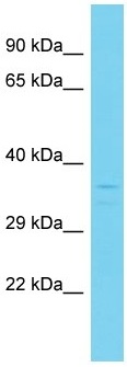 Anti-C4orf27 antibody - N-terminal (ab157673) at 1 µg/ml + 721_B cell lysate at 10 µg
