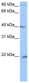 Anti-C4orf33 antibody (ab105864) at 0.5 µg/ml + Jurkat cell lysate at 10 µg