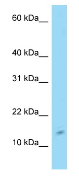 Anti-C4orf46 antibody (ab125429) at 1 µg/ml + 293T cell lysate at 10 µg