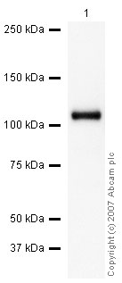 Anti-C5 / C5b antibody (ab46151) at 1 µg/ml + Human Complement C5 Protein at 0.1 µgSecondaryGoat polyclonal to Rabbit IgG - H&L - Pre-Adsorbed (HRP) at 1/3000 dilutionPerformed under reducing conditions.