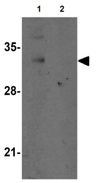 All lanes : Anti-C5orf19 antibody (ab106462) at 1 µg/mlLane 1 : Mouse lung tissue lysateLane 2 : Mouse lung tissue lysate with blocking peptideLysates/proteins at 15 µg per lane.